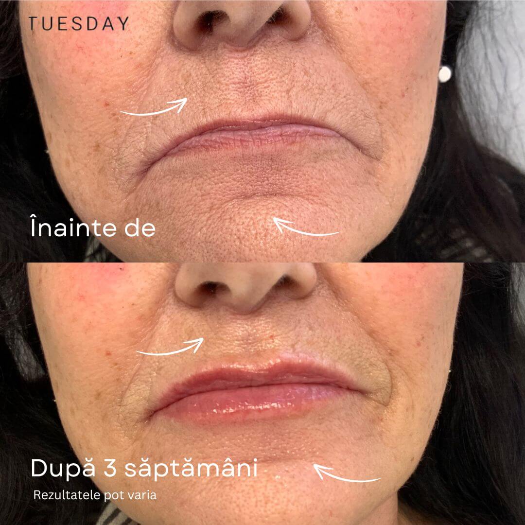 Ser anti-îmbătrânire din aur 24K